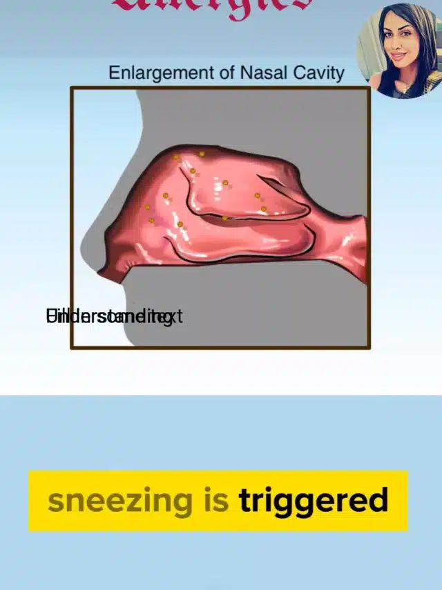 Understanding Allergies: Causes, Symptoms, and How to Manage Them