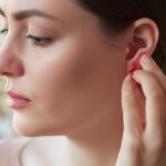 Calm Your Itchy Ears: A Doc Talks Ear Eczema